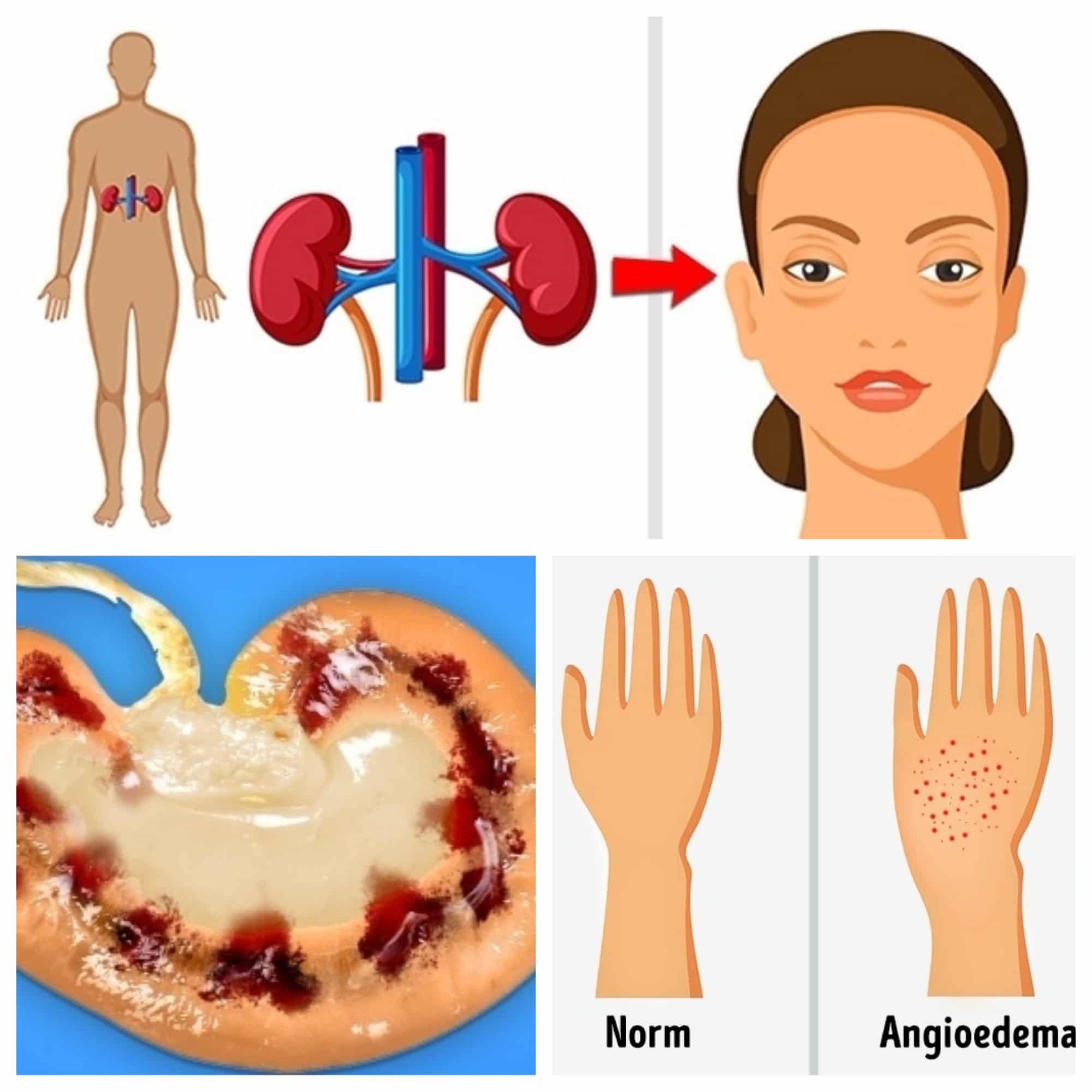 Безымянный коллаж