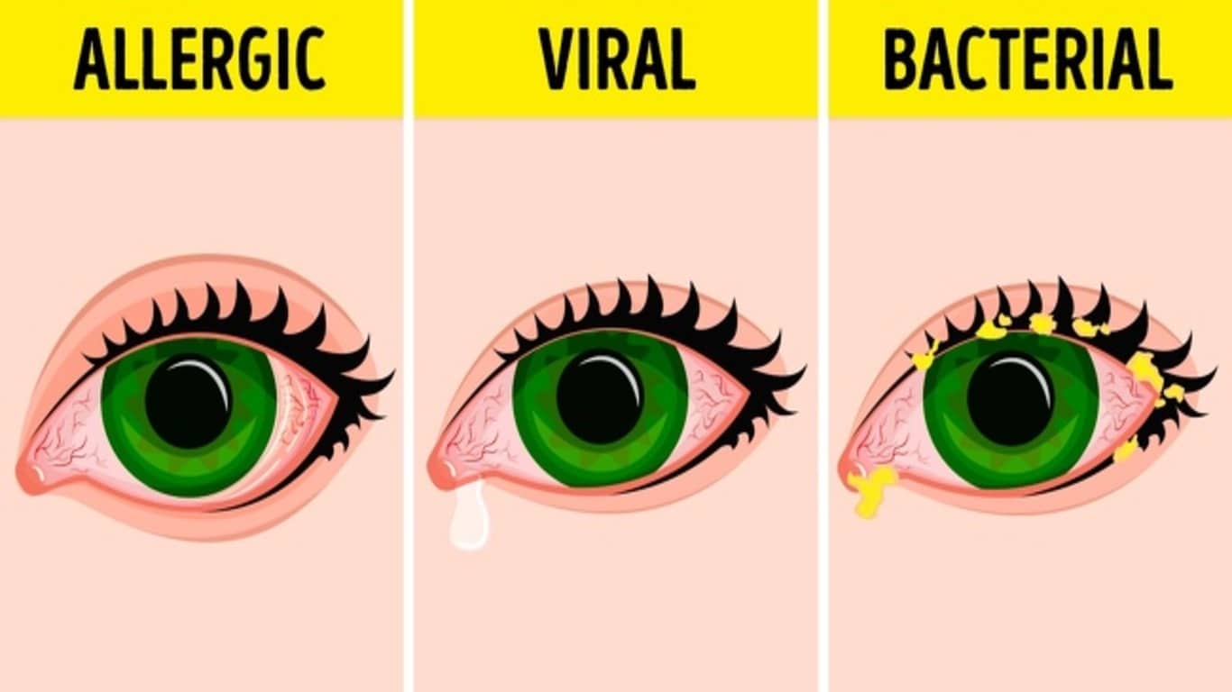 imgonline-com-ua-Resize-6TGCWBODDr