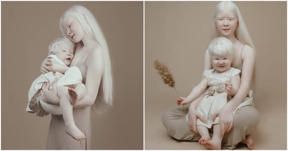 Удивительные сестры-альбиносы из Казахстана поражают мир своей необычной красотой - cpykami.ru - Казахстан