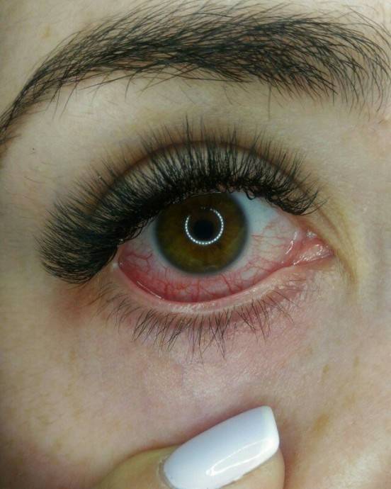 Если что-то попало в глаз - polsov.com