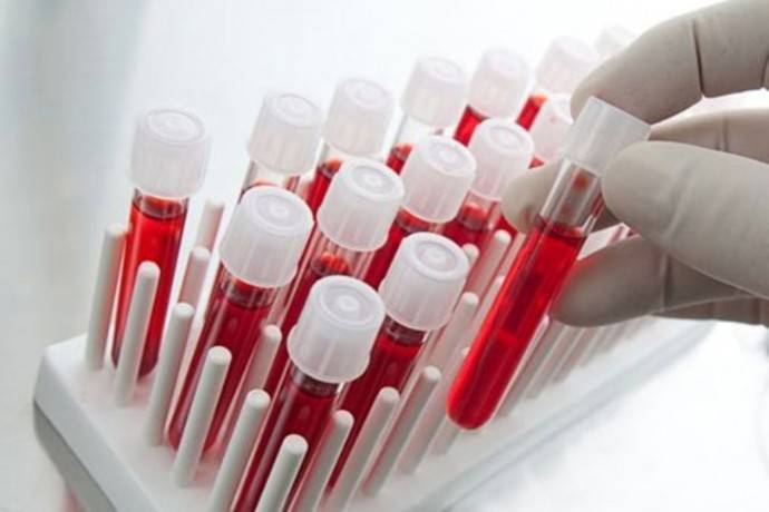 ​Как по показателям крови понять, что есть проблемы - polsov.com