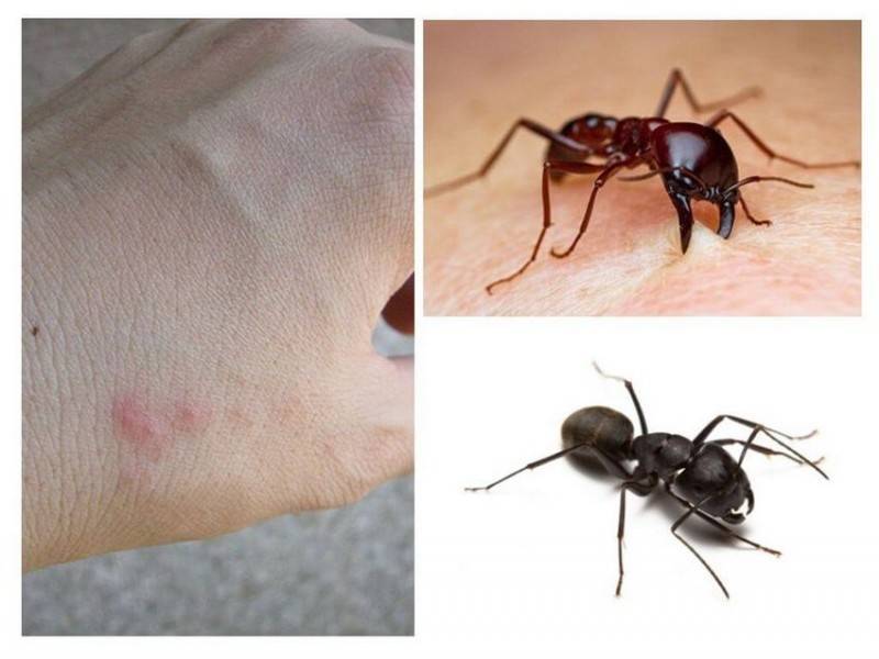 12 видов укусов насекомых и что делать при каждом из них (часть 2) - liveinternet.ru