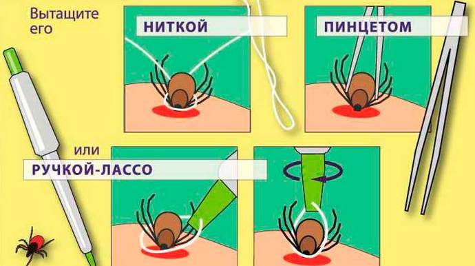 12 видов укусов насекомых и что делать при каждом из них (часть 1) - polsov.com