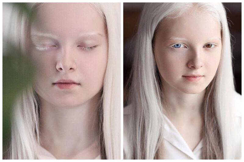 Девочка-альбинос из Чечни поразила своей уникальной внешностью - bigpicture.ru - Казахстан