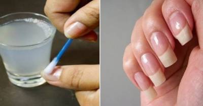 ​Как сделать ногти белыми и крепкими - polsov.com