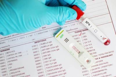 Что такое анализ крови на ХГЧ и как к нему подготовиться - epochtimes.com.ua