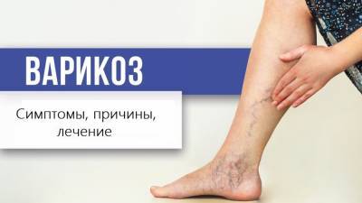 Что такое Варикоз? Причины, симптомы, лечение - new-lifehuck.ru