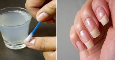 ​Как сделать сделать ногти белыми и крепкими - polsov.com