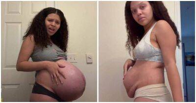 Мама 4-х детей решилась показать, как на самом деле выглядит тело женщины после родов - cpykami.ru