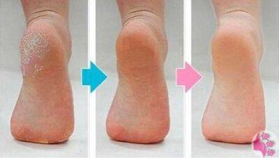 Нежные пяточки - polsov.com