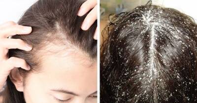 Реально работающий трюк, который останавливает выпадение волос. Просто натрите кожу головы солью - cpykami.ru