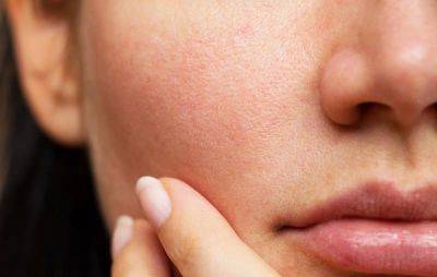Маска из петрушки эффективно сужает поры на лице: простой рецепт - nashsovetik.ru