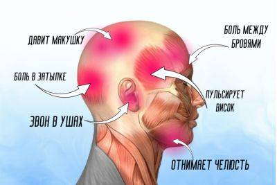 О чем говорит боль в разных частях головы: от мигрени до воспаления нерва - liveinternet.ru