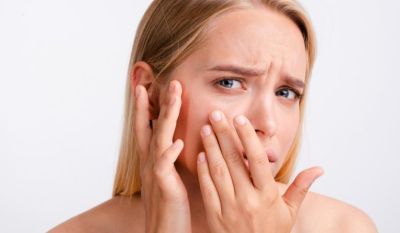 Процедуры, которые помогут при куперозе - all-for-woman.com