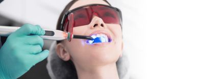 Что такое метод ICON и как он работает при лечении кариеса - nashsovetik.ru