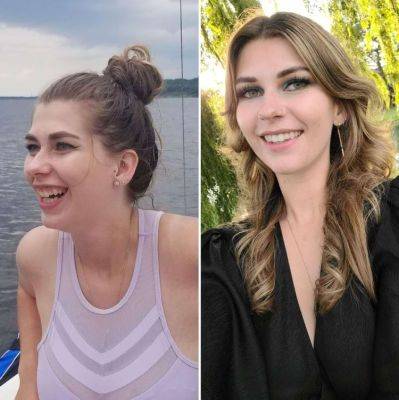 Люди, которые не побоялись лечь под нож пластического хирурга - all-for-woman.com