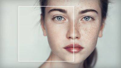 Фототерапия или лазерное удаление пигментации, что выбрать? - nashsovetik.ru