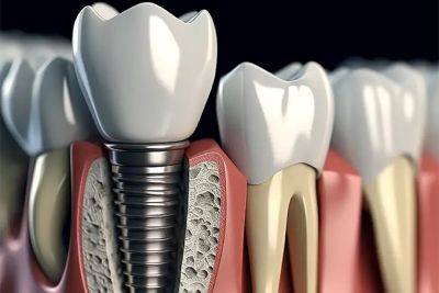 Биосовместимость стоматологических материалов: современные исследования - nashsovetik.ru