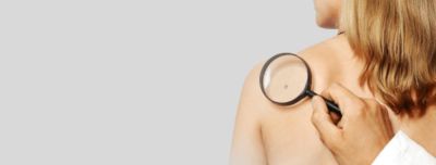 Нужно ли удалять родинки: как принять взвешенное решение - nashsovetik.ru