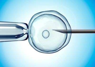 Этапы ЭКО: как проходит путь от стимуляции до переноса - nashsovetik.ru